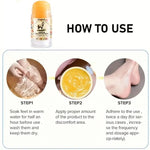 Hand & Foot Roll On for Roughness & Dryness 40gm - Digit Lounge